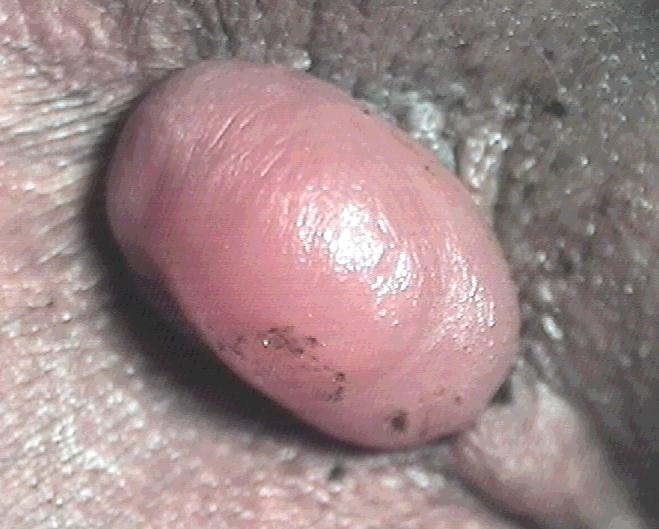 案例