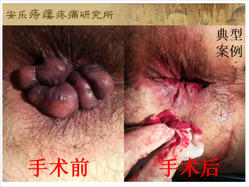 典型案例