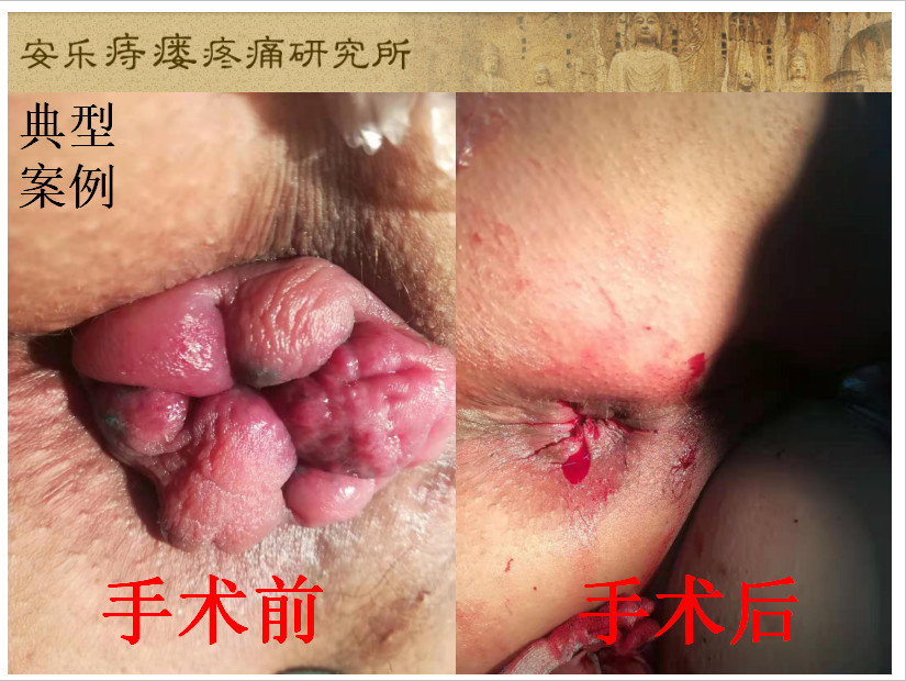 典型案例